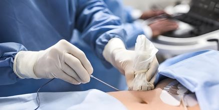 Interventional Procedures